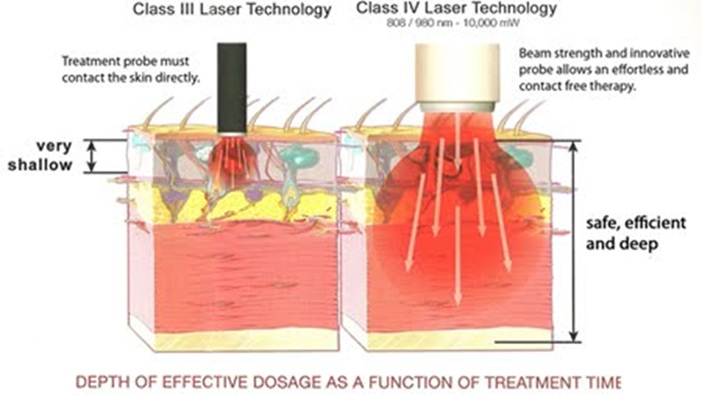 KDT Laser Difference KDT Laser Difference